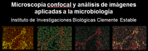 Microscopía confocal y análisis de imágenes aplicadas a la microbiología